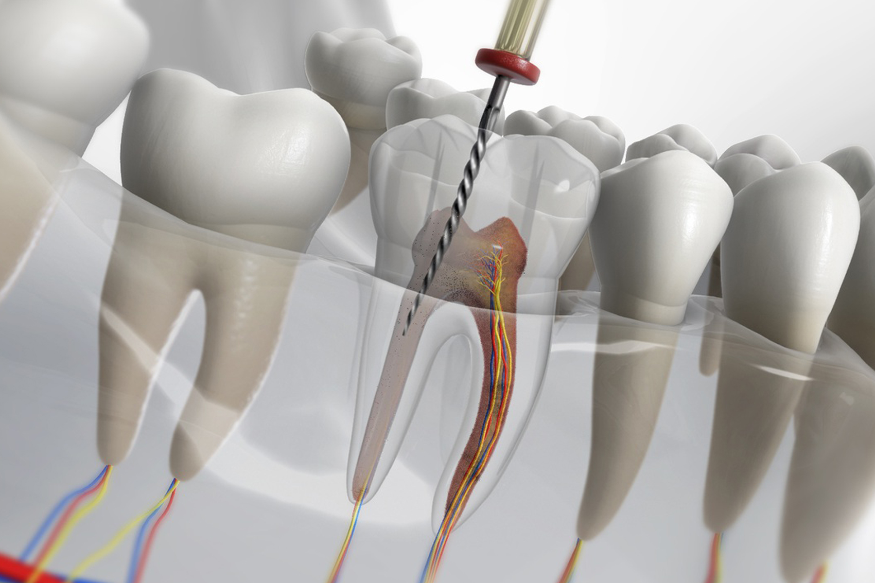 The Process and Benefits of Root Canal Treatment